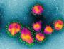 Le email di Fauci rivelano una operazione di “controllo dei danni” in risposta allo studio indiano secondo cui il coronavirus e’ stato creato in laboratorio
